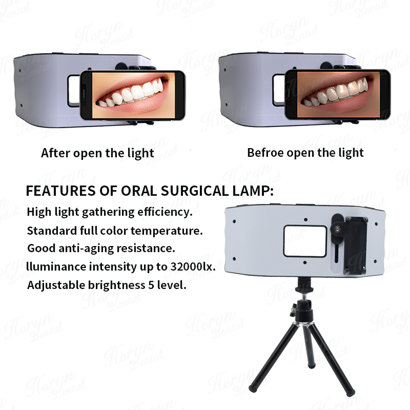 Dental Flash Light Sprzęt foto – Photography Lighting Equipment recenzja i cena